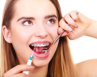 How to keep your braces clean?- treatment at Mooresville dental care 