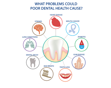 Surprising connection between your Oral and Physical Health- treatment at Mooresville dental care 
