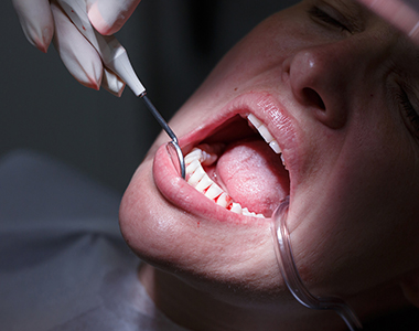 Facts you should know about Gum Disease- treatment at Mooresville dental care 