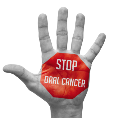 Top 5 Risk Factors for Oral Cancer- treatment at Mooresville dental care 