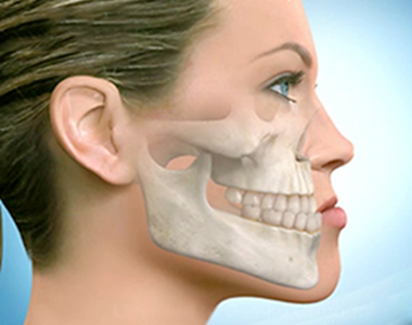 Causes and Treatments for Underbite- treatment at Mooresville dental care