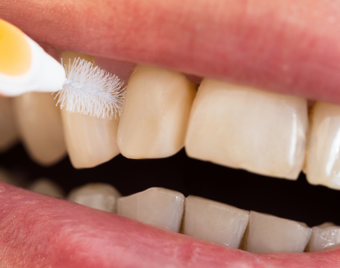 Cleaning between teeth: the secret behind a healthy smile- treatment at Mooresville dental care