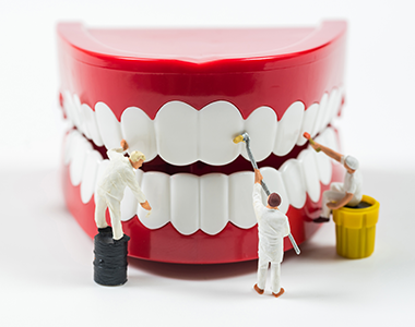 Teeth whitening- treatment at Mooresville dental care