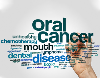 Oral cancer- treatment at Mooresville dental care 