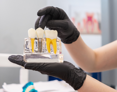 What to Expect from a Dental Implant- treatment at Mooresville dental care 